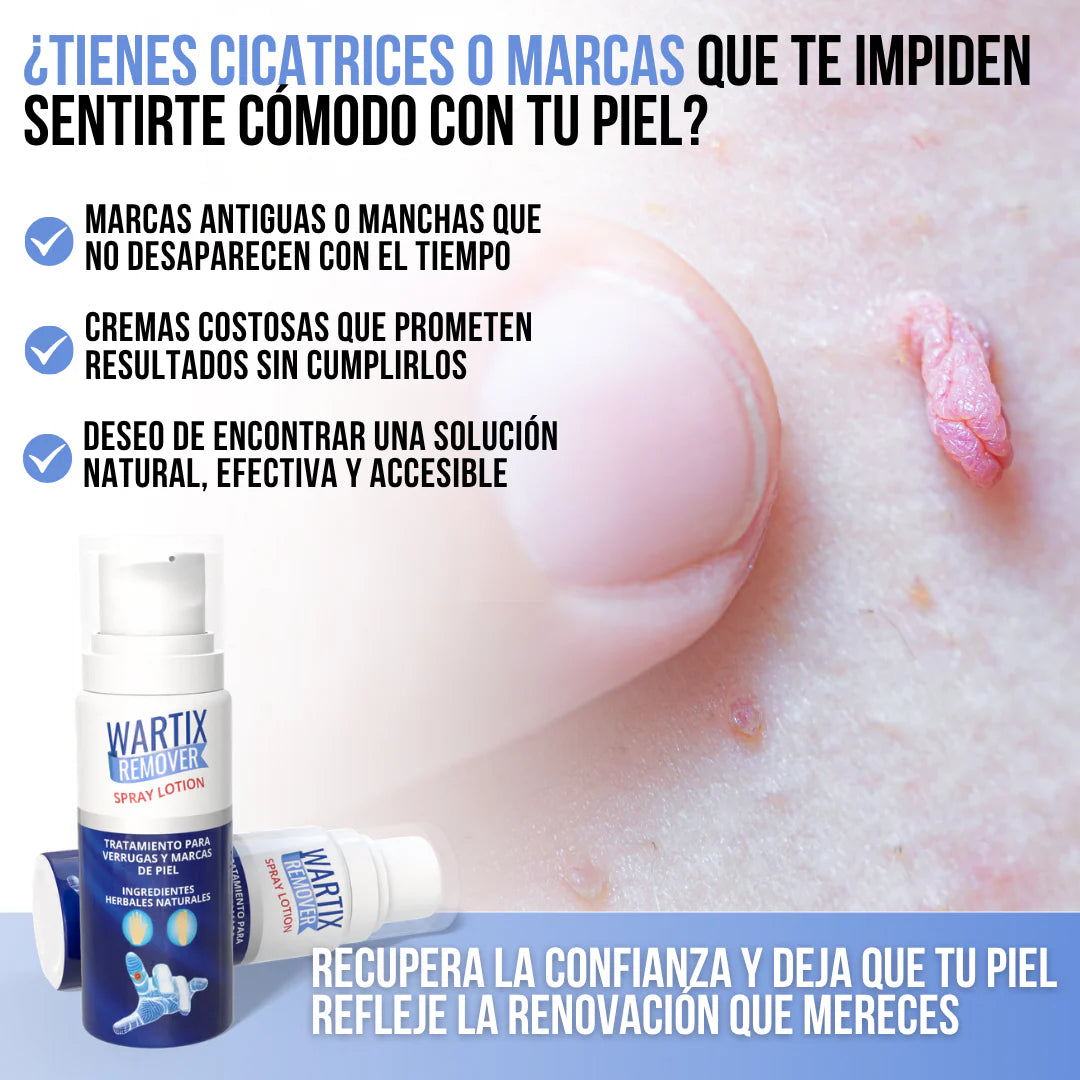 WARTIX REMOVER™ - Elimina verrugas y lunares con suavidad y rapidez