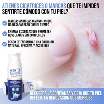 WARTIX REMOVER™ - Elimina verrugas y lunares con suavidad y rapidez