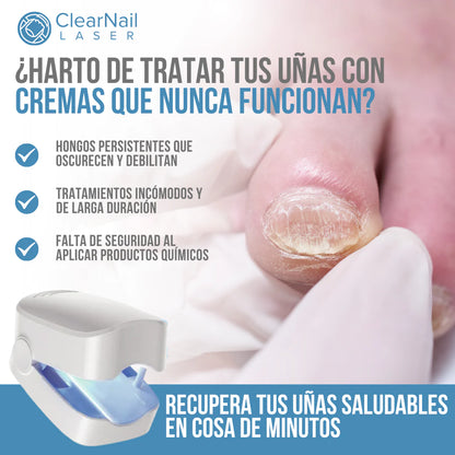 ClearNail Laser™ - Uñas sanas y fuertes desde la primera semana