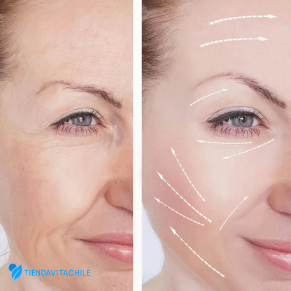 Retinal Shot Tightening Booster™ - Lifting visible sin agujas en 7 días
